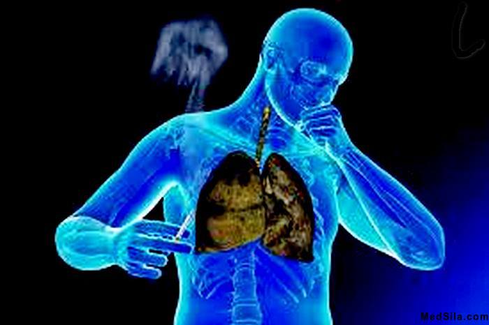 Курильщик изнутри