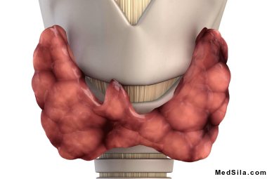 щитовидная железа